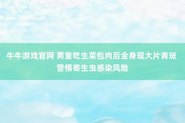 牛牛游戏官网 男童吃生菜包肉后全身现大片青斑 警惕寄生虫感染风险